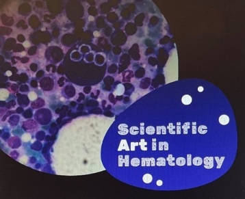 Scientific Art in Hematology